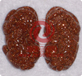 ��ɳʯ����